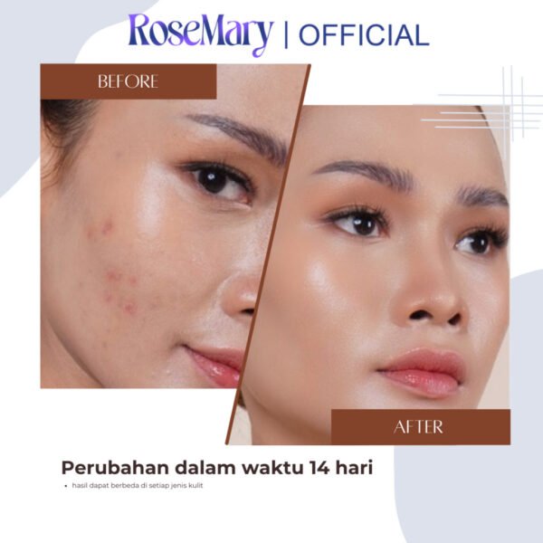 ROSEMARY AHA Ceramide Essence Toner 100 ml | Brightening Toner | Soothing Toner | Barrier toner | Exfoliating toner toner badan face mist hydrating AHA Toner - Image 3