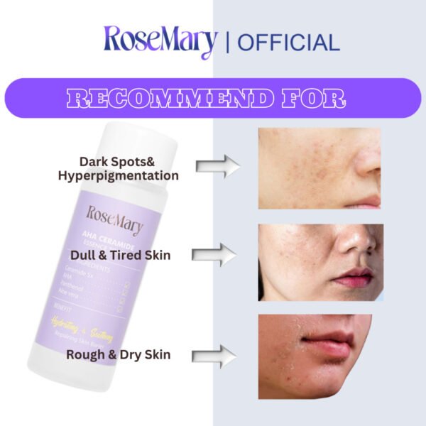 ROSEMARY AHA Ceramide Essence Toner 100 ml | Brightening Toner | Soothing Toner | Barrier toner | Exfoliating toner toner badan face mist hydrating AHA Toner - Image 7
