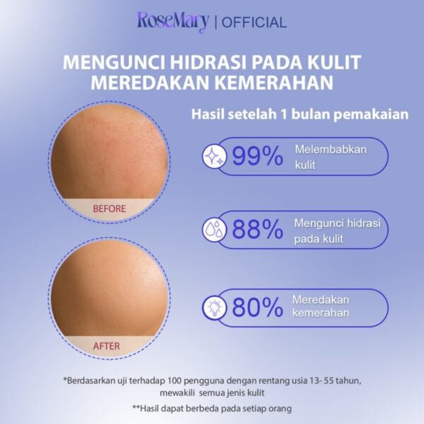 Rosemary MultiEx Hyacare Moisturizing Gel Melembabkan Redakan Iritasi Kontrol Minyak & Bekas Jerawat - Image 3
