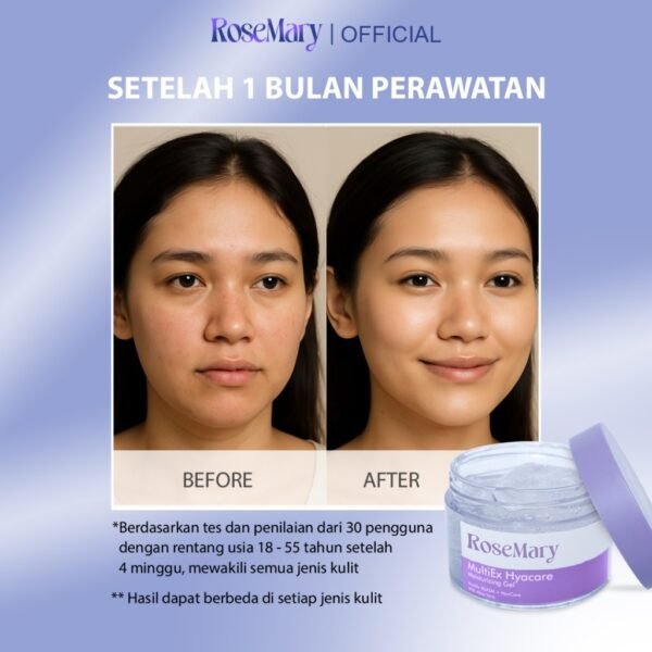 Rosemary MultiEx Hyacare Moisturizing Gel Melembabkan Redakan Iritasi Kontrol Minyak & Bekas Jerawat - Image 4